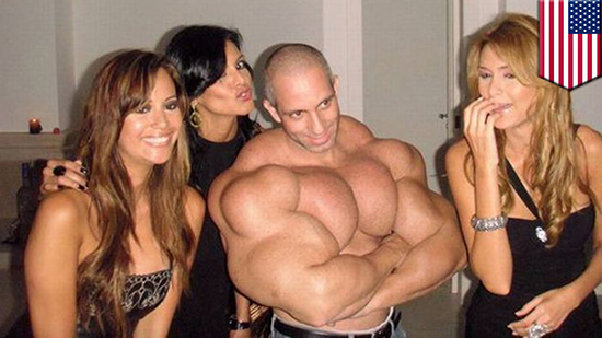 synthol10