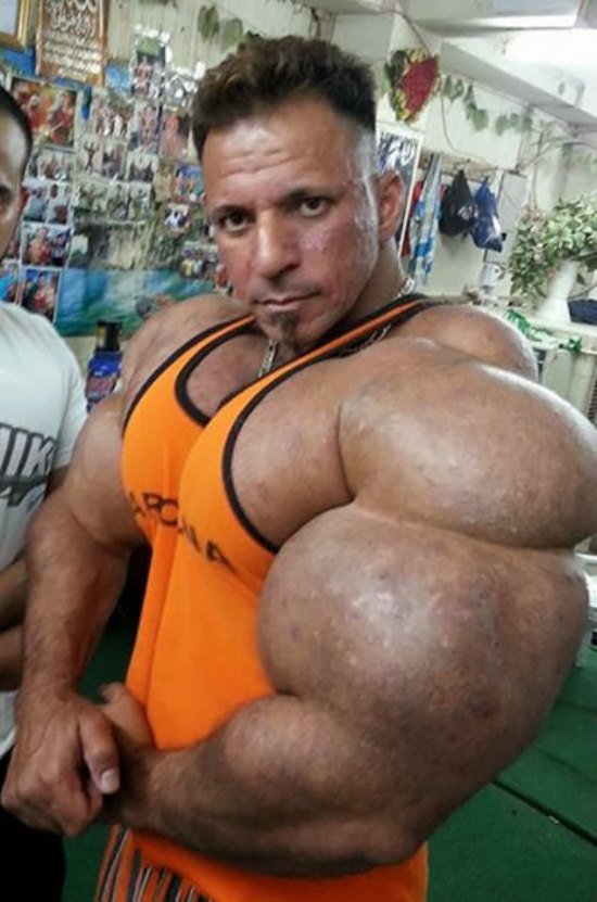 synthol2