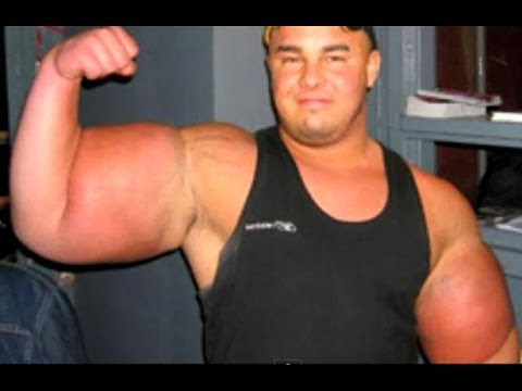 synthol6